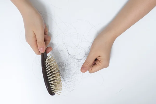 Beat Annoying Hair Loss: Top 5 Hair Regrowth Treatments in Singapore